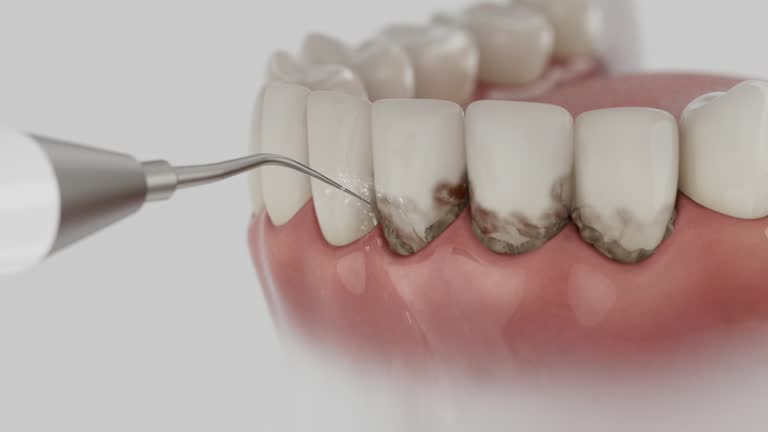 Reliable Dental contractor in California Polytechnic State University, CA by Dentist Open Now